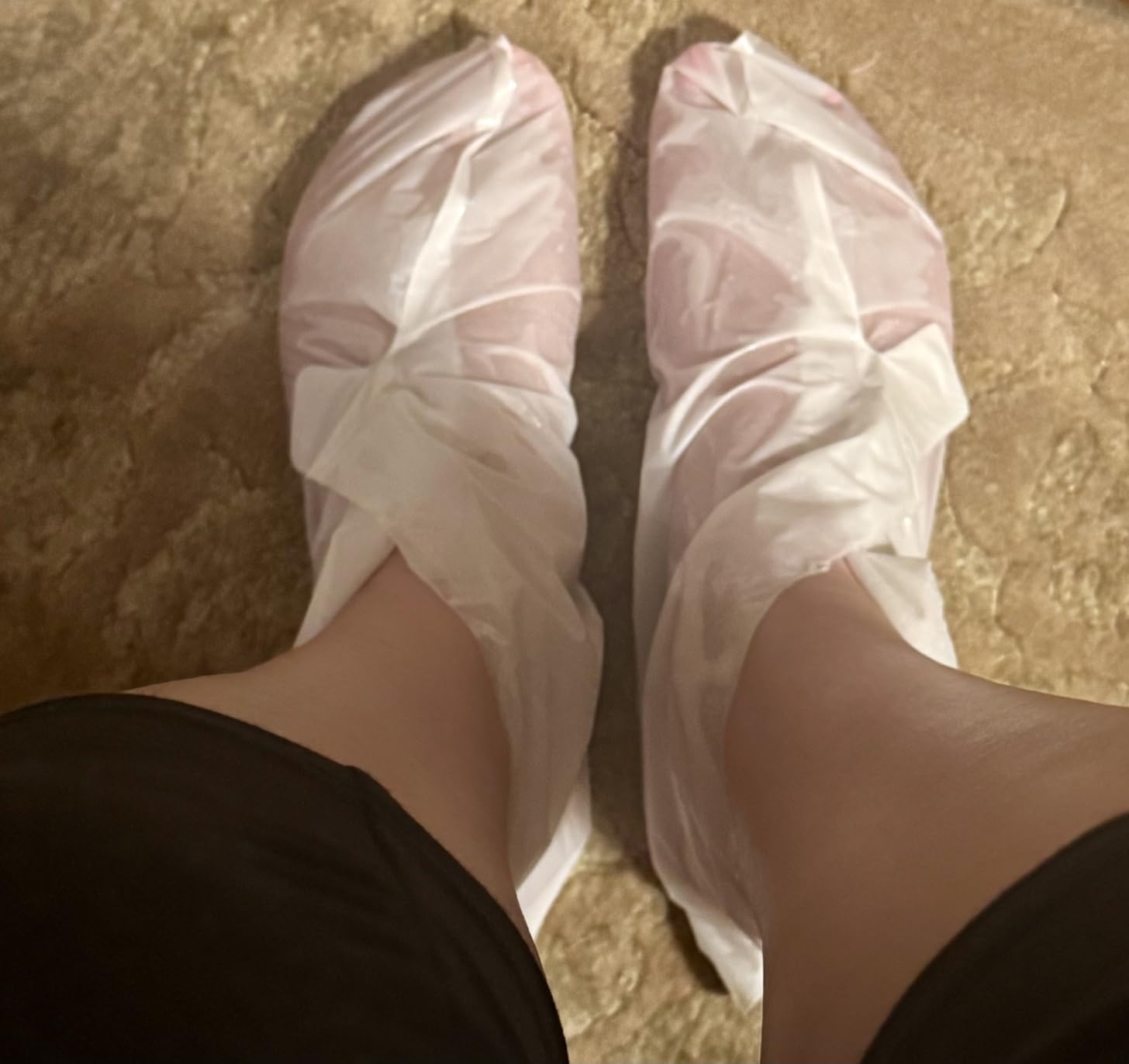 STARSKIN Magic Hour, Exfoliating Foot Mask Sock with Lactic and Glycolic Acid, Gently Removes Calluses and Dead Skin for Effective Peeling, K Beauty Skincare (1 Pack) customer photo 1
