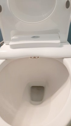 Bio Bidet Slim Zero Non Electric Bidet Toilet Seat Round, Low Profile Seat with Slow Close Lid, Battery Powered Night Light, Dual Nozzles, White customer photo 1