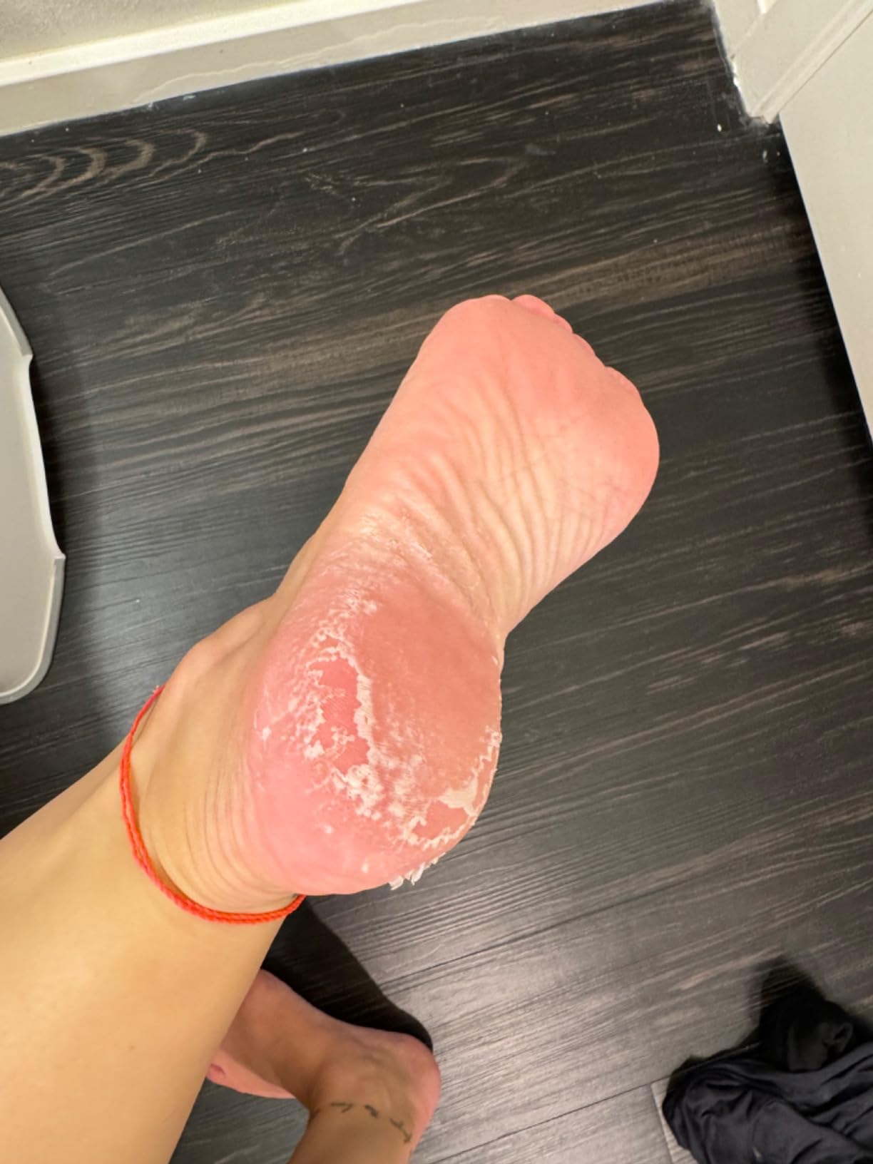 TONYMOLY Changing U Magic Foot Peeling Shoes - Exfoliating Foot Mask with AHA & Watermelon Extract for Dry, Cracked Heels & Callus Removal, Baby Soft Feet Spa Treatment, 1 Pair customer photo 1