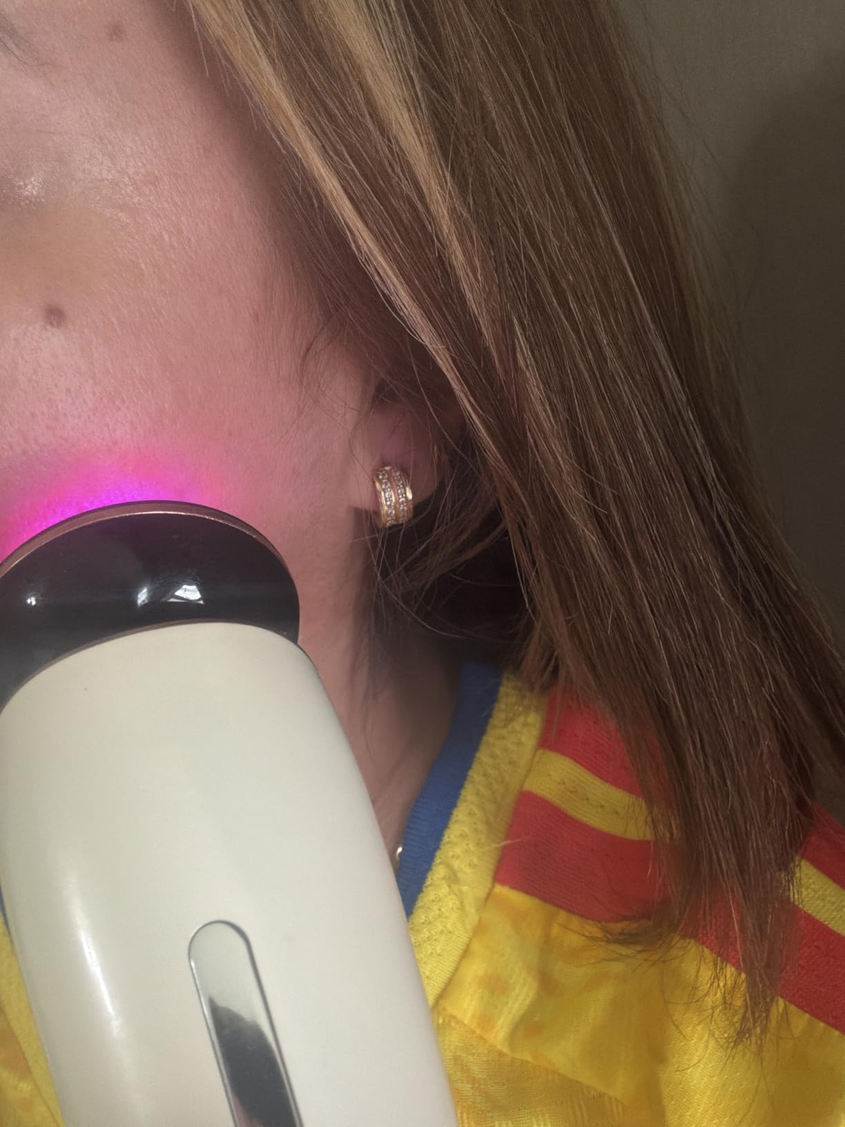 INIA 3-in-1 Red Light Therapy for Face and Neck Beauty Device for Puffiness & Skin Firming Skincare Tool (Black) customer photo 2