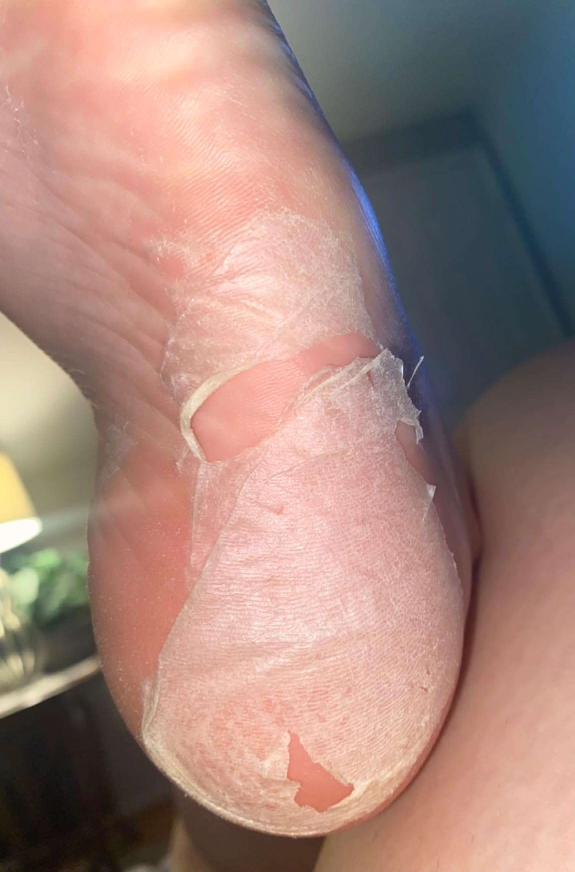 Oh K! Foot Peel Mask - Pomegranate - Foot Peeling Mask for Dry Feet and Cracked Heels - Feet Exfoliant with Pomegranate and Coconut Oil - 1 Pair customer photo 1