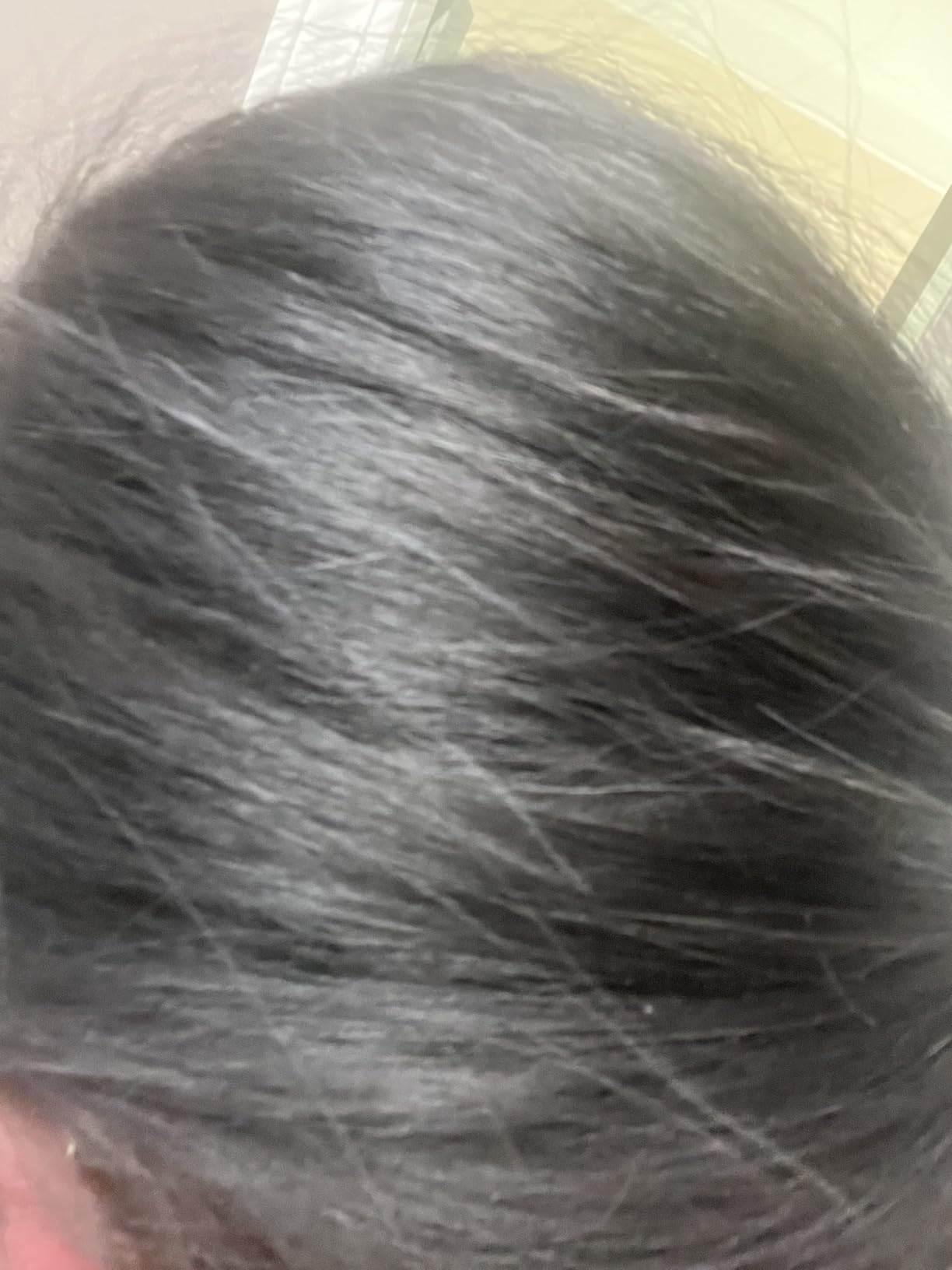 medicube Scalp Serum with Rosemary PDRN, 20ml | Non-Greasy, Lightweight Serum for Thicker, Fuller, Denser-Looking Hair - Flake-Prone Scalp Treatment, Korean Hair Care, 20ml customer photo 2