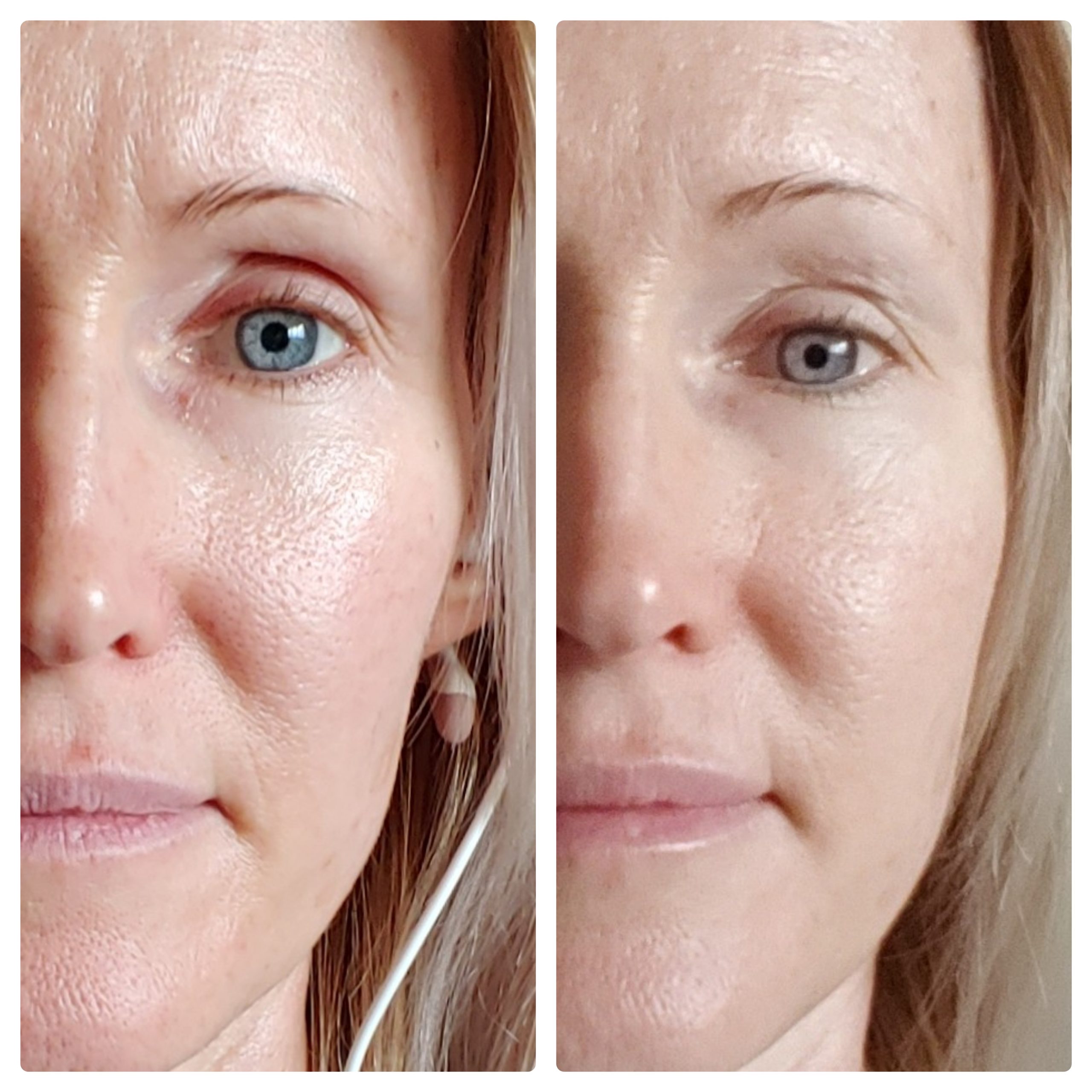 Project E Beauty Portable Rechargeable Galvanic Device | Skin Care Reduce Wrinkles Skin Tightening Firming Fine Lines Desincrustation Deep Pore Cleansing Rejuvenation Device customer photo 2
