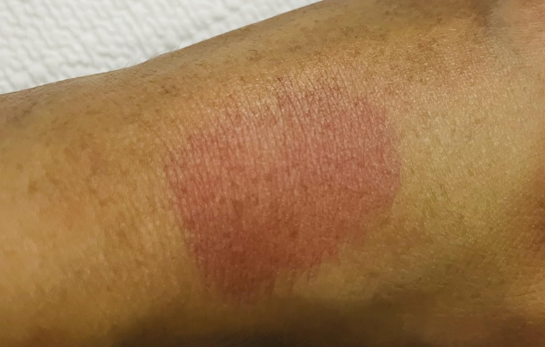 ETUDE Dear Darling Water Tint Lip and Cheek Stain, Cherry Ade, 9g | Lightweight water tint gives lips and cheeks vivid cherry color with a fresh, non-sticky and long-lasting finish. customer photo 1