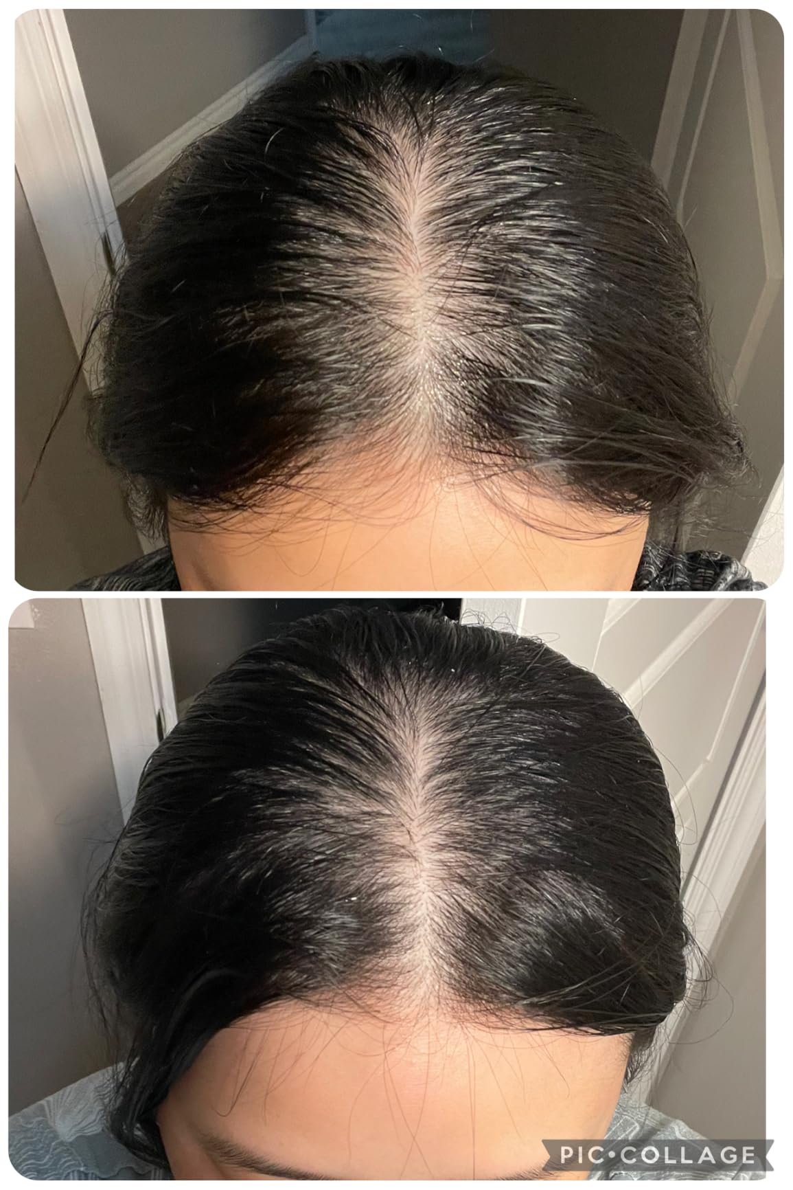 Seapuri Scalpy Hair Growth Serum for Thinning Hair | Korean Scalp Treatment with Salicylic Acid, Menthol, Dexpanthenol | Supports Hair Density & Thickening | Fuller Looking Hair & Scalp Health customer photo 2